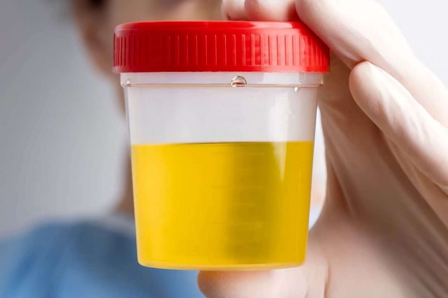 How To Get A Cat Urine Sample The Ultimate Cat Care Guide